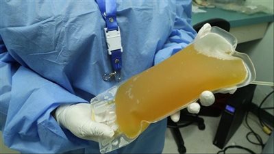  تعرف على شروط التبرع بـ بلازما الدم وعقوبة المخالفين بالقانون 