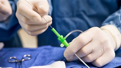 الرعاية الصحية: إنقاذ حياة مريض توقف قلبه بسبب جلطة في الشريان التاجي بتركيب دعامة الحياة 