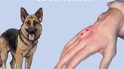 داء الكلب..الإعلان عن لقاح فموي ضد السعار قريبًا