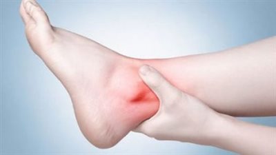 أعراض الإصابة بجلطة الرجل.. التورم والتنميل والشحوب