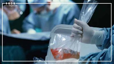 عقوبة نقل الأعضاء البشرية بالتحايل والخداع 