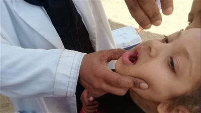 مستشار الرئيس للصحة يكشف حقيقة رصد حالات مصابة بشلل الأطفال
