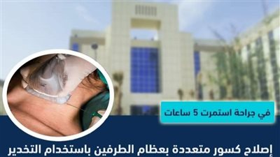 الصحة: نجاح إجراء جراحة لإصلاح كسور متعددة بالجسم استمرت 5 ساعات