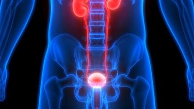 6 أسباب لحدوث انسداد مجرى البول.. احذرها