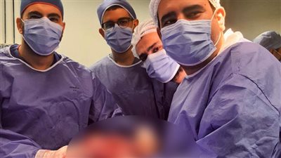 استئصال ورم بالصدر يزن 4 كيلو بالمستشفى الجامعي في المنوفية |صور