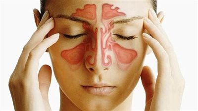 بالتزامن مع التقلبات الجوية.. نصائح مهمة لمرضى الجيوب الأنفية والحساسية | فيديو