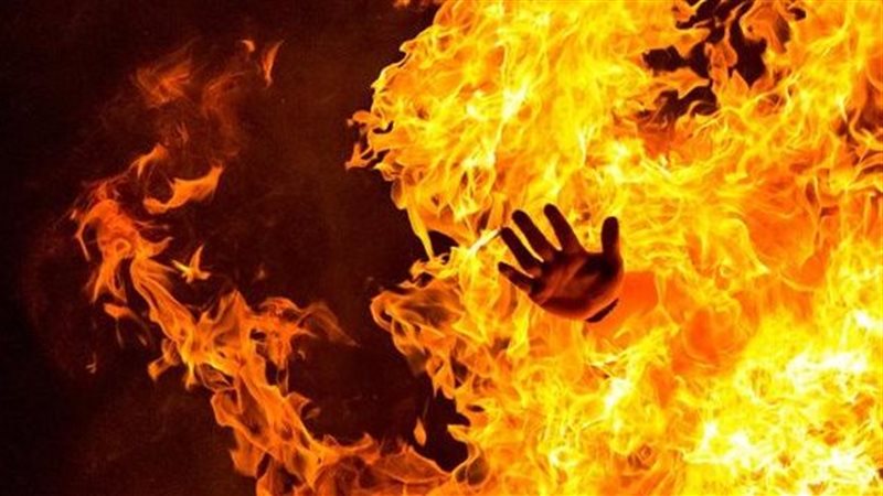 وصلة مزاح تنتهي بحرق