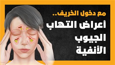 مع دخول الخريف.. أعراض التهاب الجيوب الأنفية | إنفوجراف