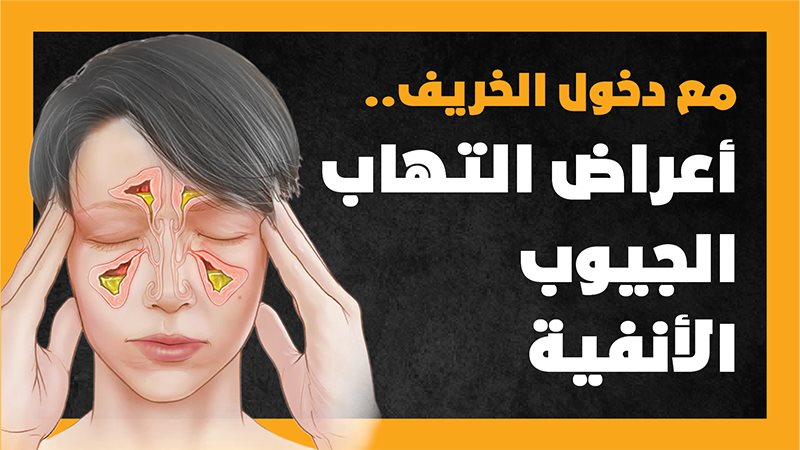 الجيوب الأنفية 