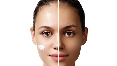 وصفات تفتيح البشرة لإزالة آثار الصيف من اسمرار وتصبغات