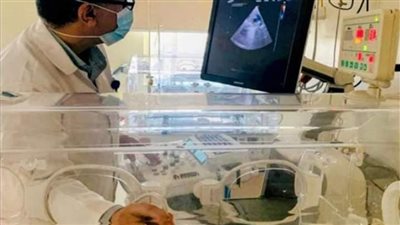 الرعاية الصحية: إنقاذ حياة 4 أطفال مبتسرين في حالة حرجة