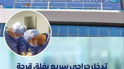 نجاح تدخل جراحي سريع بغلق قرحة بالإثنى عشر بمستشفى فايد التخصصي