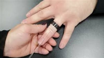 احذر.. أفعال بسيطة تؤدي لقطع الدم عن الأطراف وتسبب البتر