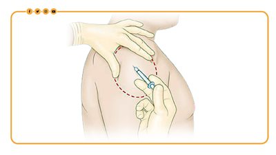 9 أعراض خطيرة تظهر عند الحقن العضلي الخاطئ | انفوجراف