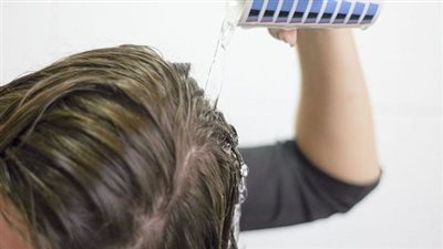 فوائد لا تتخيليها عن الخل على الشعر.. لا تفوتك 