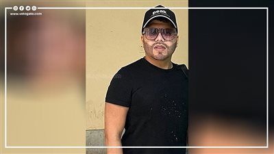 تغير ملامح عمر كمال في أول ظهور في النقابة بعد الجراحة