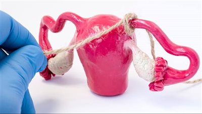 مخاطر انسداد قناة فالوب وطرق العلاج