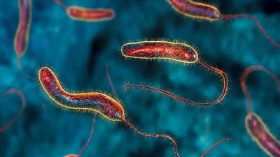 كل ما تريد معرفته عن عدوى الكوليرا