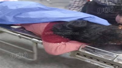 معلمة تعتدي على تلميذة وتصيبها بنزيف في المخ بالشرقية 