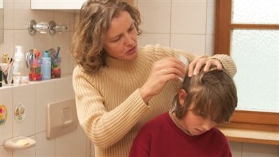 كيف تتخلصين من حشرات الشعر عند الأطفال؟ 