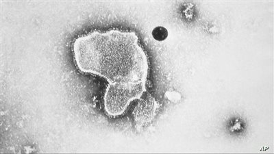 يمثل لغزا وسبب وفيات الرضع.. علماء يحذرون من 