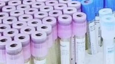 ضبط 18 ألف أنبوبة تحليل دم منتهية الصلاحية وcoverglass بطنطا|صور