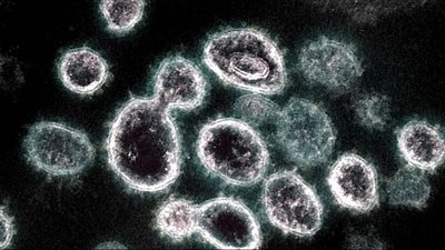 أطول إصابة كورونا بالعالم.. بريطاني يتعافى بعد 411 يوما 