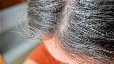 4 أسباب وراء ظهور الشعر الأبيض وطرق التخلص منه