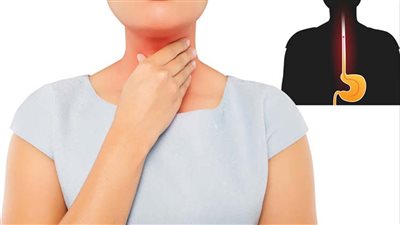 علاج ارتجاع المريء في المنزل بدون أدوية