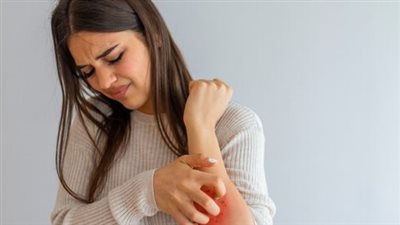 استشاري يوضح أسباب وطرق تجنب الإصابة بحساسية الجلد 