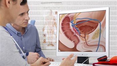 أعراض مرض البروستاتا.. وأسباب الإصابة وطرق العلاج