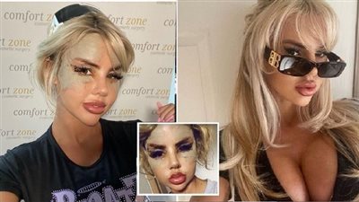 عارضة أزياء بريطانية تلجأ لتركيا من أجل 