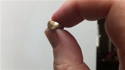 ممرض يسرق ضرسا ذهبيا من فم ميت