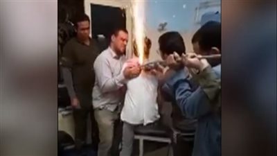 بطول 5 أمتار.. تفاصيل استخراج سيخ حديد اخترق ظهر عامل وخرج من صدره بالبساتين| فيديو 