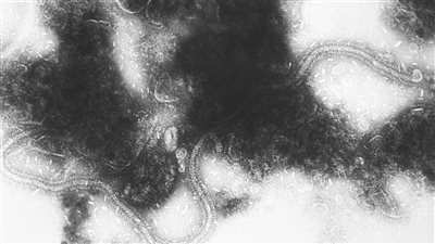 تحركات برلمانية لمواجهة تزايد أعداد المصابين بالفيروس المخلوي التنفسي.. مطالب للجنة إدارة الأزمات بعقد اجتماع عاجل.. ونائب يحذر من الحقنة السحرية