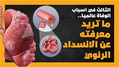 الثالث في أسباب الوفاة عالميا.. ما تريد معرفته عن الانسداد الرئوي | انفوجراف 