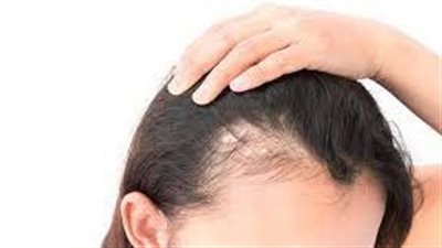 7 أسباب وراء تساقط الشعر بغزارة 