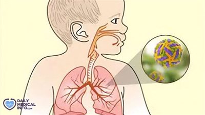 أستاذ مناعة يكشف خطورة فيروس المخلوي التنفسي