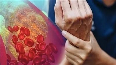 دراسة: فائدة الكوليسترول 