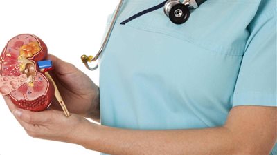 علاج حصوات الكلى بمواد طبيعية وفي أسرع وقت