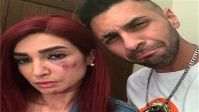 بعد نهال عنبر.. فنانون أصيبوا داخل لوكيشن التصوير