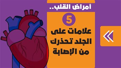 أمراض القلب.. 5 علامات على الجلد تحذرك من الإصابة | فيديو جراف