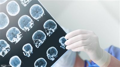 ينقذ الملايين.. علماء يتوصلون لتقنية تقضي على اقتلاع جذور الأورام السرطانية 