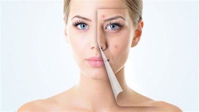 روشتة هاني الناظر لتجنب حب الشباب وتقصف الشعر في الخريف | فيديو