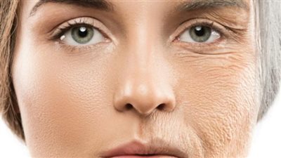 المخللات والحلوى تسبب ظهور التجاعيد المبكرة.. احذريها