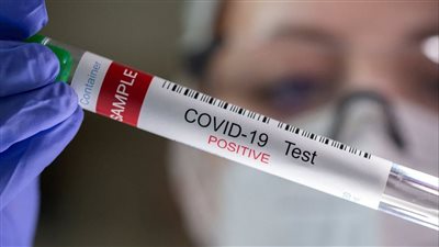  الأسوأ قادم.. دراسة تحذر من متحور جديد لـ كورونا يسبب الوفاة.. ومخاوف من تكرار كارثة ووهان 