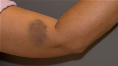 علامات بجسمك لا تتجاهلها لأنها خطيرة.. باحث يوضح