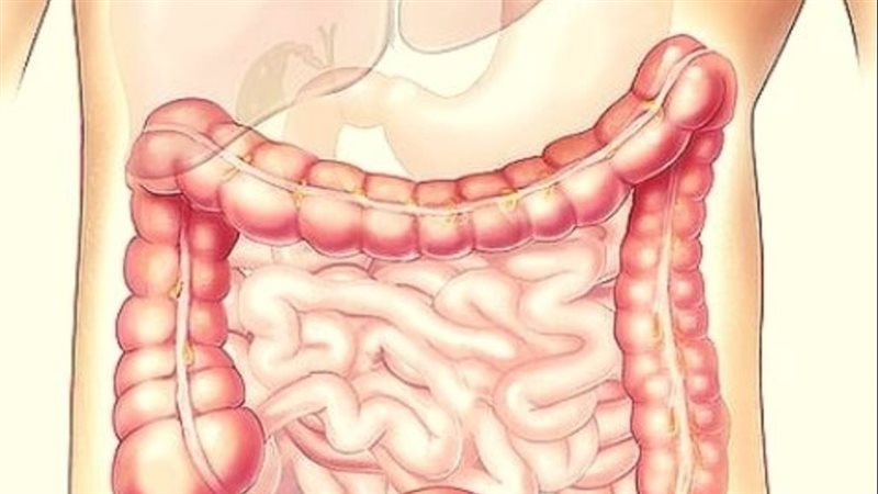 أعراض الزائدة