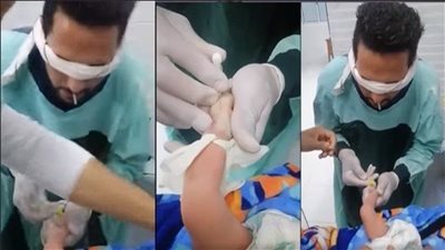 مفاجأة في واقعة تركيب الكانيولا، ممرض المنيا خريج أكاديمية أغلقها وزير التعليم العالي 