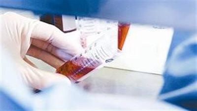 بيزنس‭ ‬العلاج‭ ‬بالخلايا‭ ‬الجذعية، بنوك‭ ‬حفظ‭ ‬الخلايا‭ ‬تستقطب‭ ‬المصريين‭ ‬بعروض‭ ‬مميزة‭ ‬وأقساط‭ ‬حسب‭ ‬الدخل‭ 